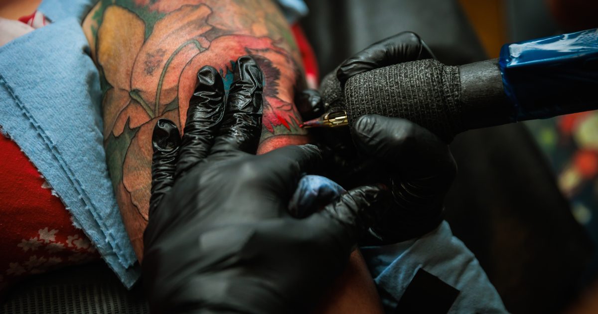 Tattoo Removal Long Beach CA Your Guide to Lasting Results
